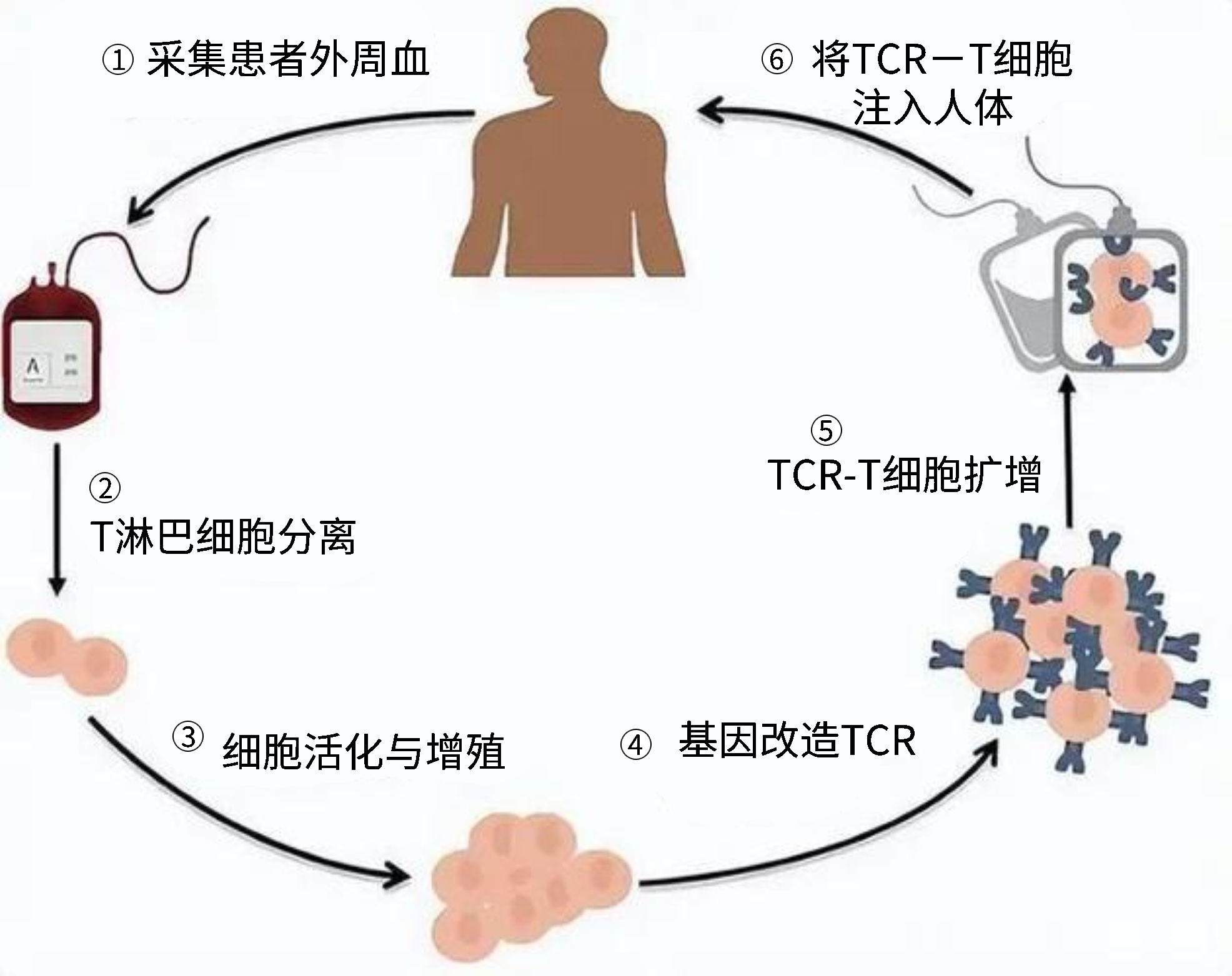 TCR-T流程.jpg